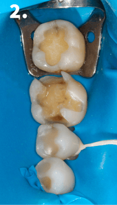 CLINICAL CASE RAFAEL BEOLCHI 2