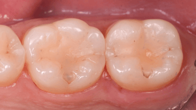 Paolone 1