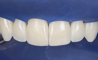 Transcend Mascetti 7